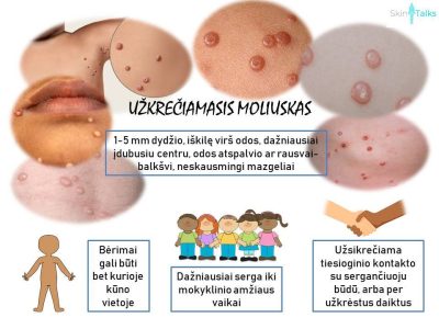 Visuomenės sveikatos specialistės informacija